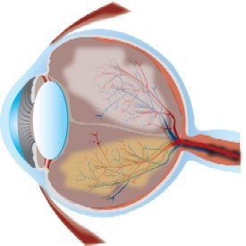 Macular Degeneration Cure